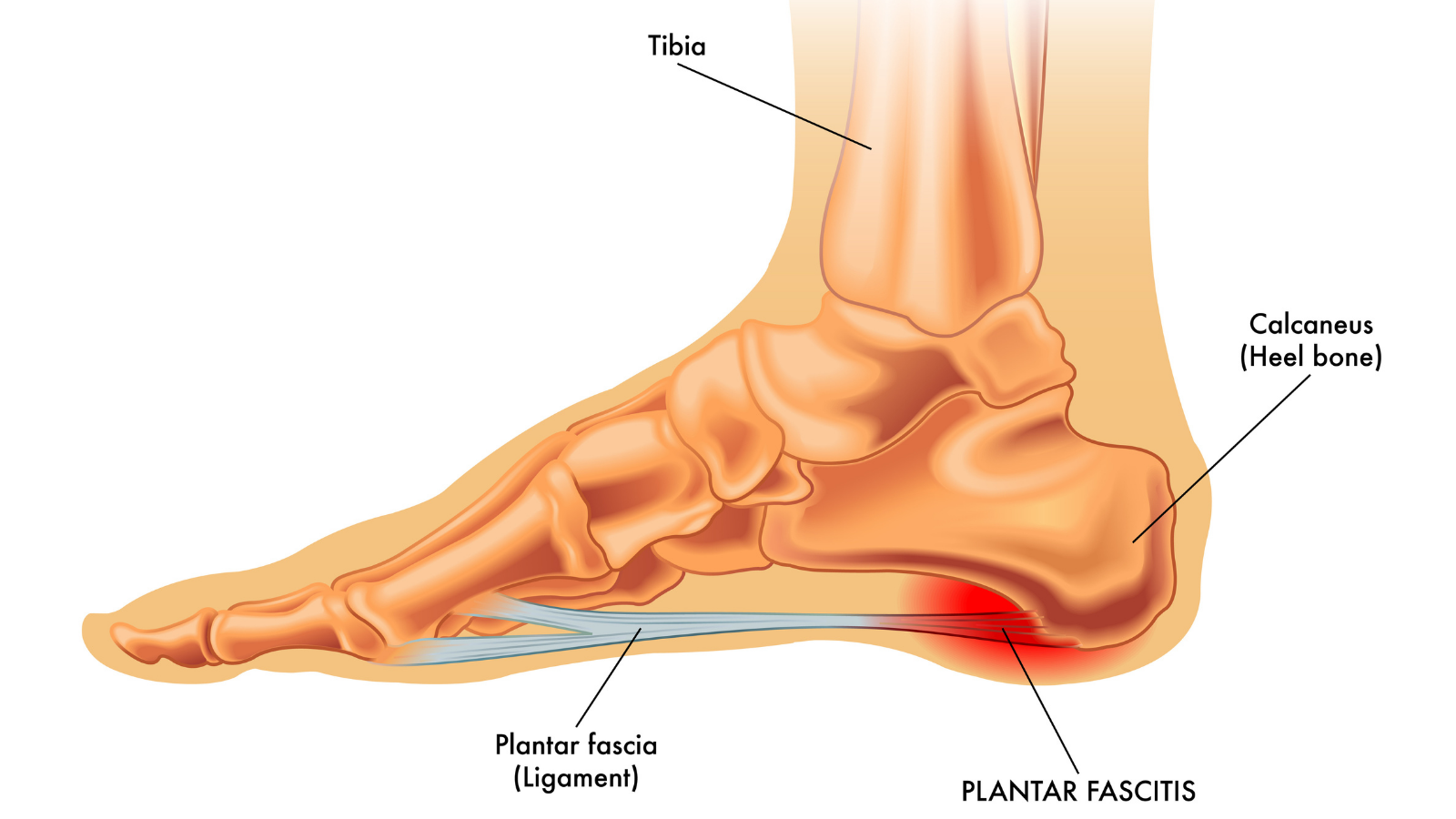 Image showing foot anatomy and where sciatica can strike
