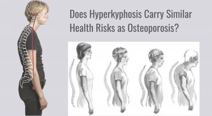 drawing showing the spine in forward head posture and hyperkyphosis